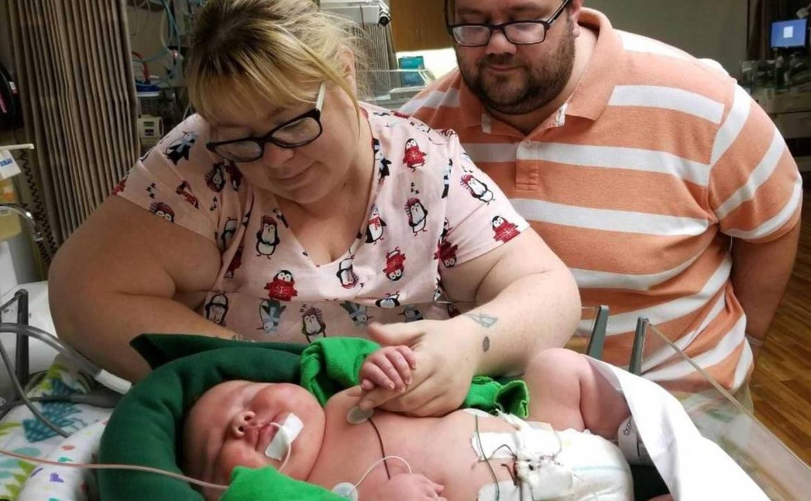 مولود يحطم رقما قياسيا ويذهل الأطباء